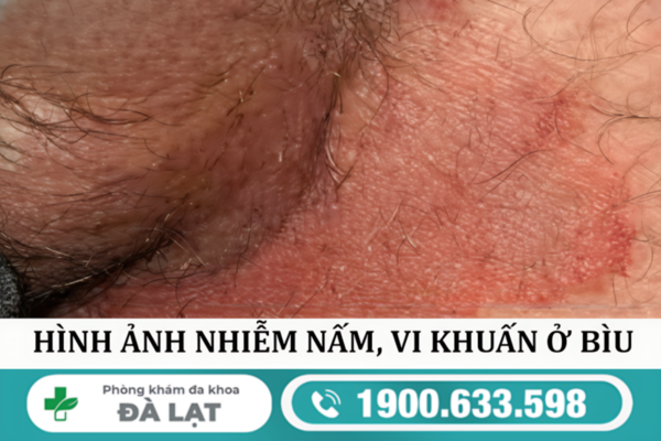 Hình ảnh minh họa